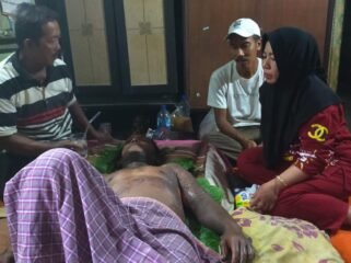 Edi Syahputra, pedagang bakso yang tubuhnya melepuh tersiram air mendidih pada Kamis (6/6/2024) lalu.