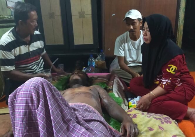 
Edi Syahputra, pedagang bakso yang tubuhnya melepuh tersiram air mendidih pada Kamis (6/6/2024) lalu.